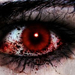 blood eye