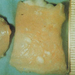 sarcocystis gigantea (Ov oesophagus)