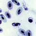 plasmodium lophurae (kacsa)